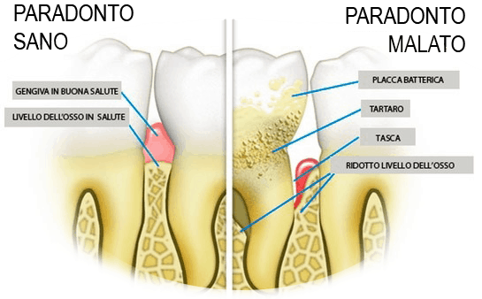 paradantosanoe_malato1-MIN