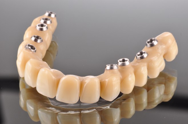 denti fissi con piorrea