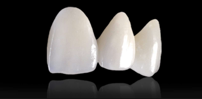 Corone EMAX