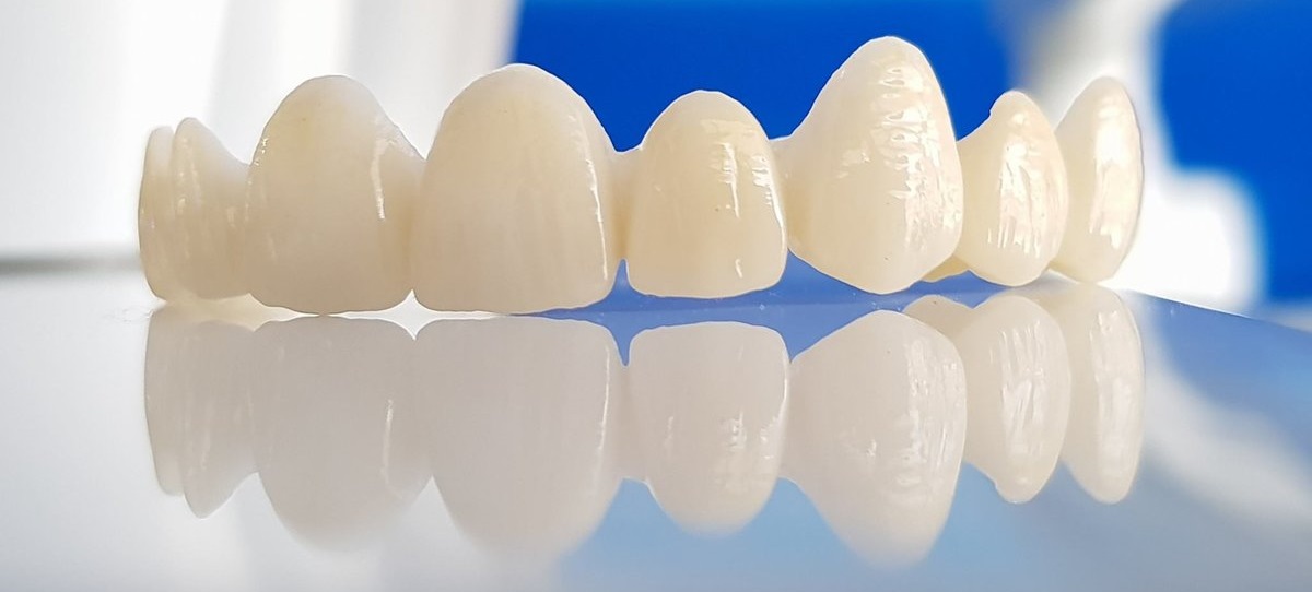 Corone Dentali Zirconio