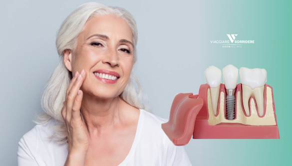 Implants dentaires avec peu d’os: est-ce possible?