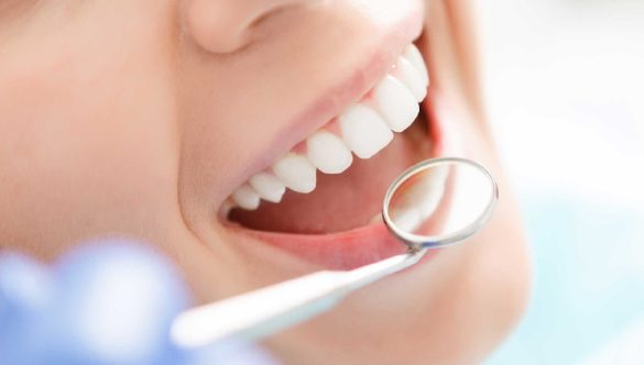 I Viaggi all’Estero per le Cure Dentali